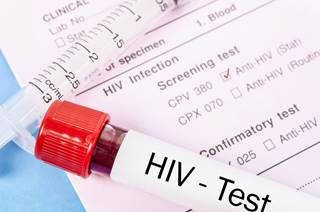 Prevention programs of mother-to-child transmission of HIV require sequential and coordinated interventions antenatally, during labor and delivery, and after birth. Prevention programs of mother-to-child transmission of HIV require sequential and coordinated interventions antenatally, during labor and delivery, and after birth.