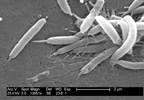 Resistance to Antibiotic Treatments for H pylori Infection Resistance to Antibiotic Treatments for H pylori Infection
