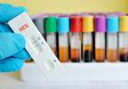 HCV Reinfection Rates Examined Following Successful Treatment HCV Reinfection Rates Examined Following Successful Treatment