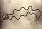 Sensitivity and Specificity of 7 Treponemal Tests for Syphilis Diagnosis Sensitivity and Specificity of 7 Treponemal Tests for Syphilis Diagnosis