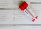 Low HIV, Syphilis Screening Rates for Adolescents With Pelvic Inflammatory Disease Low HIV, Syphilis Screening Rates for Adolescents With Pelvic Inflammatory Disease