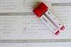 Low HIV, Syphilis Screening Rates for Adolescents With Pelvic Inflammatory Disease Low HIV, Syphilis Screening Rates for Adolescents With Pelvic Inflammatory Disease