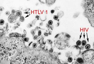 These results support treating HCV in all patients with HIV/HCV coinfection, even patients with low-grade fibrosis. These results support treating HCV in all patients with HIV/HCV coinfection, even patients with low-grade fibrosis.