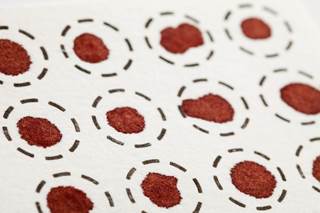 This new detection tool has the potential to increase patients’ access to diagnosis and vaccination. This new detection tool has the potential to increase patients’ access to diagnosis and vaccination.