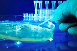 With the increasing emergence of resistant bacterial pathogens, the spectrum of potentially active agents has narrowed in many instances. With the increasing emergence of resistant bacterial pathogens, the spectrum of potentially active agents has narrowed in many instances.