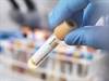 How Often Should We Test for Hepatitis C in People Who Inject Drugs? How Often Should We Test for Hepatitis C in People Who Inject Drugs?