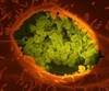 New Q Fever Foci Identified, Including Acute Endocarditis, Lymphadenitis New Q Fever Foci Identified, Including Acute Endocarditis, Lymphadenitis