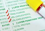 Sustained Hepatitis C Treatment Associated With Lower Risk for Cardiovascular Events Sustained Hepatitis C Treatment Associated With Lower Risk for Cardiovascular Events