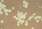 Study to Test Efficacy of Liposomal Amphotericin for Cryptococcal Meningitis Study to Test Efficacy of Liposomal Amphotericin for Cryptococcal Meningitis
