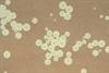 Study to Test Efficacy of Liposomal Amphotericin for Cryptococcal Meningitis Study to Test Efficacy of Liposomal Amphotericin for Cryptococcal Meningitis