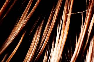 The predictive utility of antiretroviral concentrations in hair samples was examined in a large trial. The predictive utility of antiretroviral concentrations in hair samples was examined in a large trial.