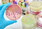 Vitamin C Treatment May Be Beneficial for Sepsis, But Duration and Dose Unclear Vitamin C Treatment May Be Beneficial for Sepsis, But Duration and Dose Unclear