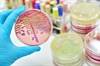 Vitamin C Treatment May Be Beneficial for Sepsis, But Duration and Dose Unclear Vitamin C Treatment May Be Beneficial for Sepsis, But Duration and Dose Unclear