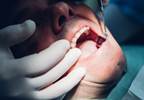 Antibiotic Prophylaxis Before Dental Procedures May Be Unnecessary Antibiotic Prophylaxis Before Dental Procedures May Be Unnecessary