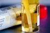SGLT2 Inhibitors and Urinary Tract Infections: What's the Link? SGLT2 Inhibitors and Urinary Tract Infections: What's the Link?