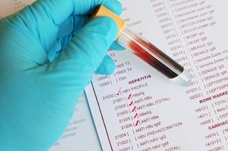 The overall seroprevalence of vaccine-induced immunity against hepatitis B virus among noninstitutionalized Americans at high risk for hepatitis B virus infection was persistently low. The overall seroprevalence of vaccine-induced immunity against hepatitis B virus among noninstitutionalized Americans at high risk for hepatitis B virus infection was persistently low.