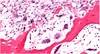 Bone Health in Human Immunodeficiency Virus Infection Bone Health in Human Immunodeficiency Virus Infection