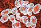 Patient Develops Glandular Tularemia After Taking Care of Sick Cat Patient Develops Glandular Tularemia After Taking Care of Sick Cat