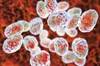 Patient Develops Glandular Tularemia After Taking Care of Sick Cat Patient Develops Glandular Tularemia After Taking Care of Sick Cat