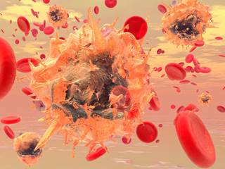 Development of liver disease was not associated with either CD4 T lymphocyte count or CD4 percentage. Development of liver disease was not associated with either CD4 T lymphocyte count or CD4 percentage.