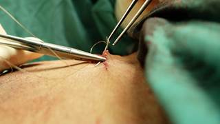 Results suggest that image-based approaches for remote postoperative assessment of surgical sites will need refinement before widespread implementation. Results suggest that image-based approaches for remote postoperative assessment of surgical sites will need refinement before widespread implementation.