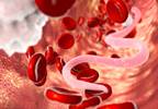 A Single Triple-Drug Treatment for Lymphatic Filariasis A Single Triple-Drug Treatment for Lymphatic Filariasis