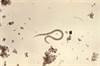 Safety of Escalating Doses of Tribendimidine in Children With Hookworm Safety of Escalating Doses of Tribendimidine in Children With Hookworm