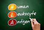 Human Leukocyte Antigen System Likely Plays a Role in Course of HBV Infections Human Leukocyte Antigen System Likely Plays a Role in Course of HBV Infections