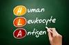 Human Leukocyte Antigen System Likely Plays a Role in Course of HBV Infections Human Leukocyte Antigen System Likely Plays a Role in Course of HBV Infections