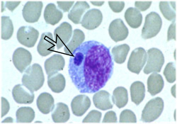 Ehrlichia and Anaplasma